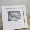 sonogram photo